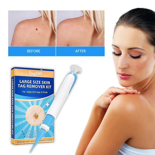 DermaErase™ - Achieve Smooth Skin Effortlessly and Quickly