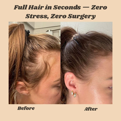 VoluStrand™ - Instantly Transform Thinning Hair for a Full, Natural Look