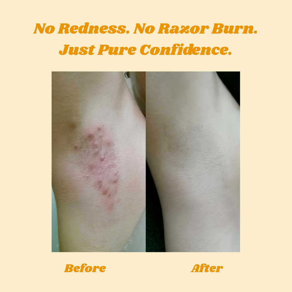 HoneyMousse™ - Silky Smooth Skin in Minutes, Zero Irritation Guaranteed